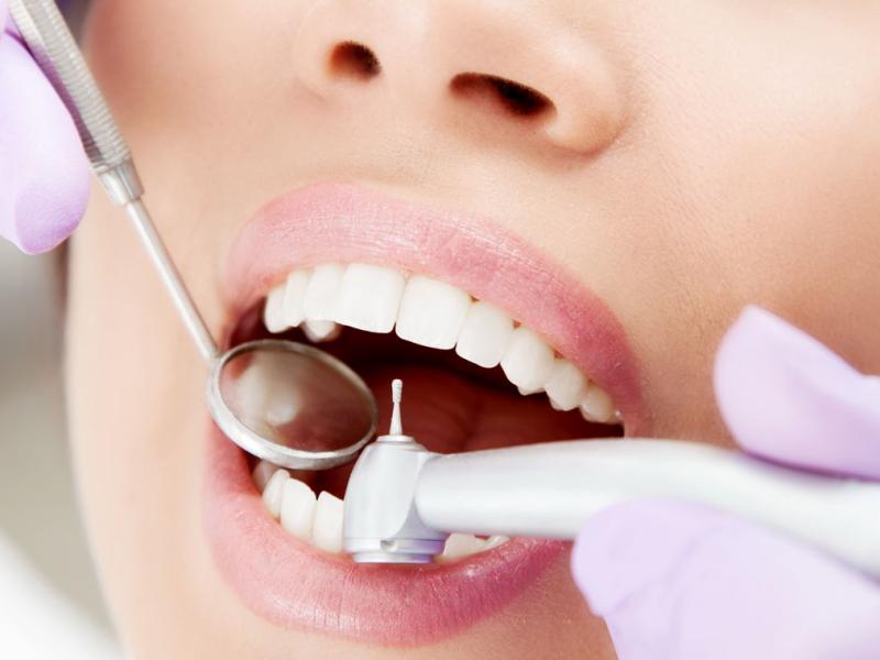 лечение кариеса зубов