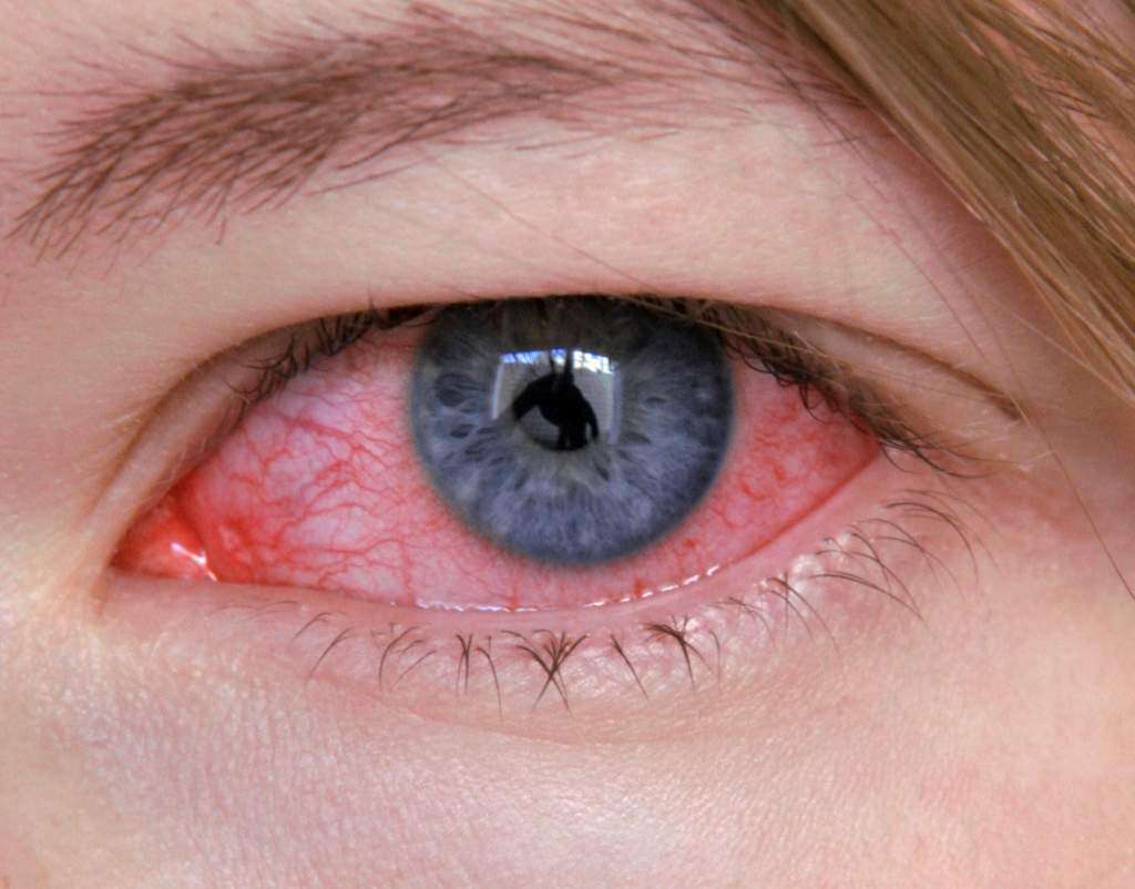 Иридология, или оценка здоровья человека и его заболеваний на основе внешнего вида глаза и особенно радужной оболочки, хотя в Польше все еще недостаточно оценена, во многих странах является важным диагностическим методом